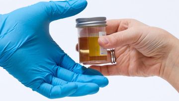 2.263 Napi hingga 235 Petugas Lapas Narkotika Jakarta Dites Urine